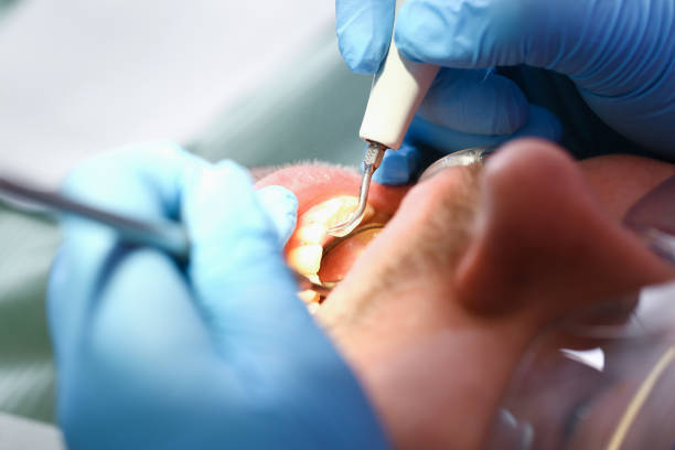 Best Emergency TMJ Treatment in Bourbonnais, IL