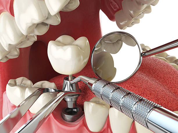 Fast & Reliable Emergency Dental Services in IL